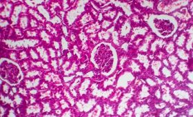 The Role of a Gastroenterologist in Preventing Serious GI Diseases